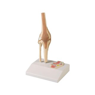 Articulación de rodilla en miniatura con sección transversal