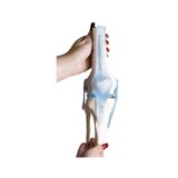 Articulación de la rodilla con ligamentos con soporte