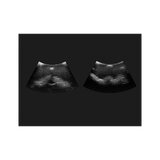 Simulator til epidural- og spinalblokade GENESIS