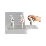 Modelo de implante de rodilla