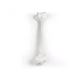 El húmero (parte superior del brazo)