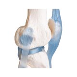 Articulación de la rodilla con ligamentos con soporte