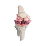 Modelo de implante de rodilla