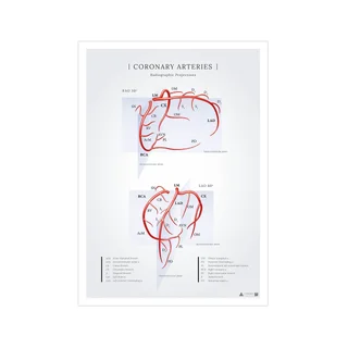 Póster sobre las arterias coronarias del corazón vistas en proyecciones radiográficas