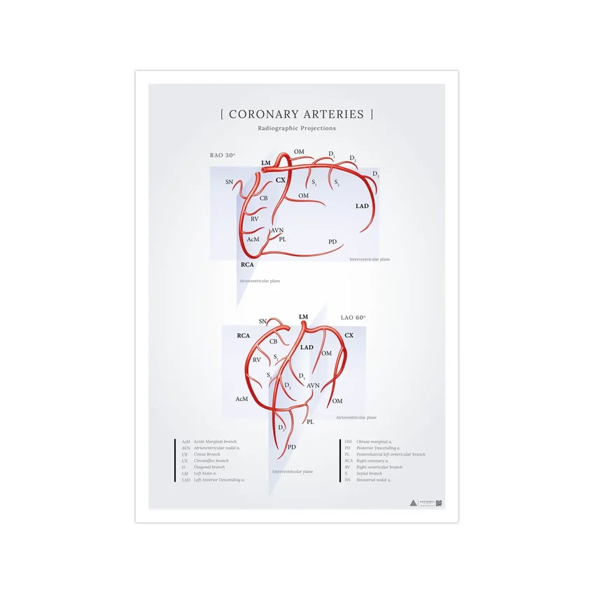 Póster sobre las arterias coronarias del corazón vistas en proyecciones radiográficas