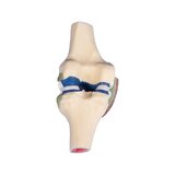 Sección longitudinal - modelo de rodilla