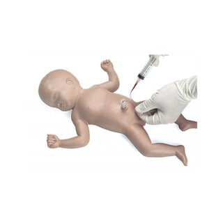 Inserción del catéter umbilical Baby Umbi