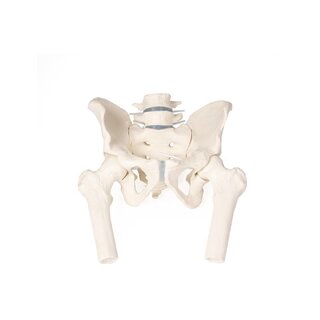 Pelvis masculina con sacro, 2 vértebras lumbares y muñones femorales