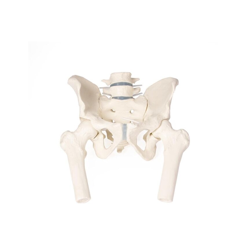 Pelvis masculina con sacro, 2 vértebras lumbares y muñones femorales