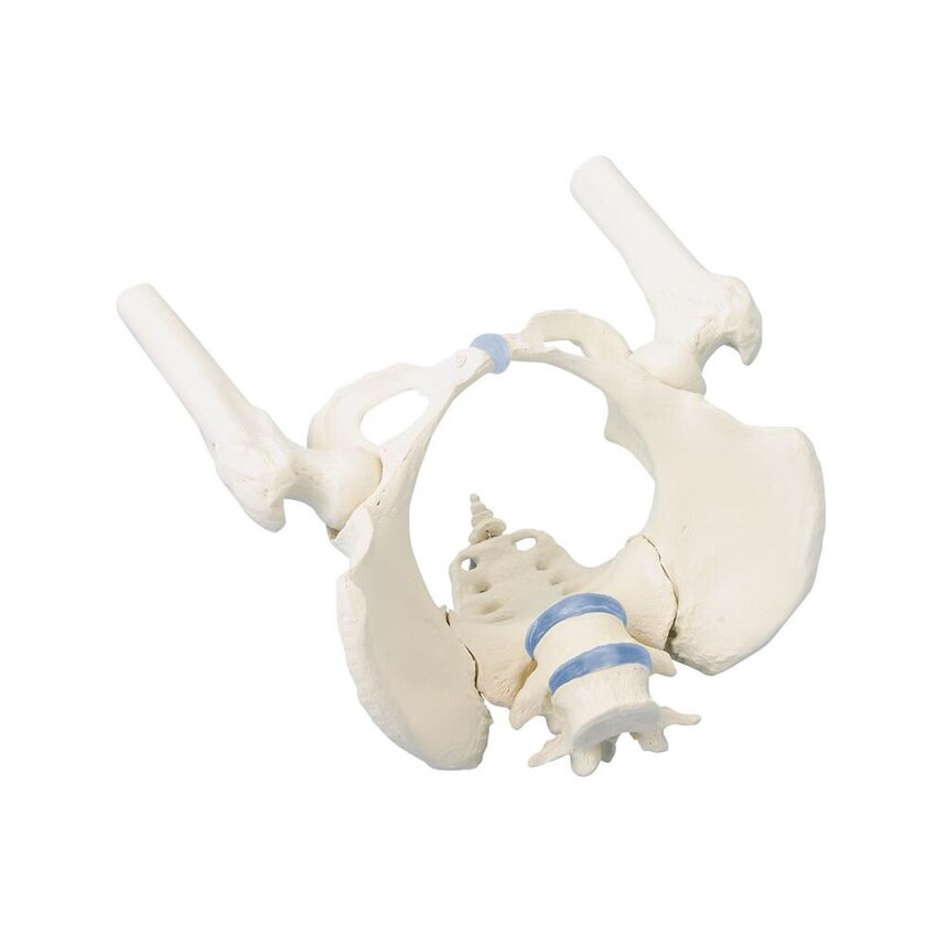 Pelvis femenina con sacro, 2 vértebras lumbares y muñones femorales