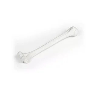 El húmero (parte superior del brazo)
