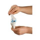 Modelo de implante de rodilla