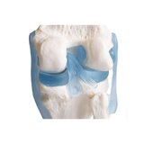 Articulación de la rodilla con ligamentos con soporte