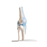 Articulación de la rodilla con ligamentos con soporte
