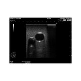 Simulator III til anlæggelse af centralt venekateter (CVK)