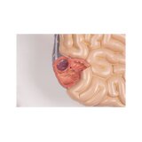 Detailed torso model with 27 removable parts (light-skinned and interchangeable genitals)