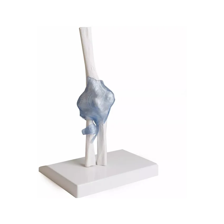 Articulación del codo con ligamentos con soporte