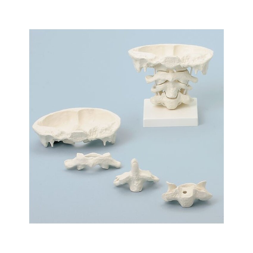The movement of the upper cervical vertebrae