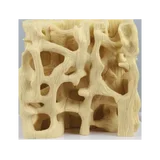 Modelo de comparación de la estructura ósea sana/osteoporótica