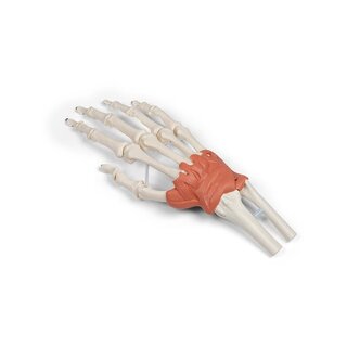 Dispositivo de ligamento en el modelo de muñeca