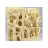 Modelo de comparación de la estructura ósea sana/osteoporótica