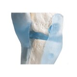 Articulación de la rodilla con ligamentos con soporte
