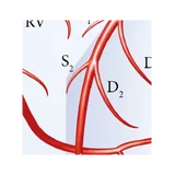 Póster sobre las arterias coronarias del corazón vistas en proyecciones radiográficas