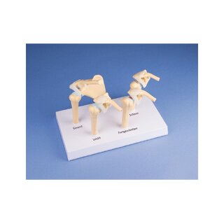 Model 4-trins slidgigt (OA) skulder