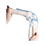 Articulación de la rodilla con ligamentos con soporte