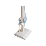 Articulación de la rodilla con ligamentos con soporte