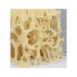 Modelo de comparación de la estructura ósea sana/osteoporótica
