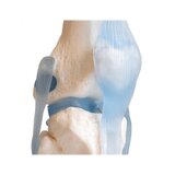 Articulación de la rodilla con ligamentos con soporte